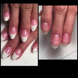 Before And After Pink And White 