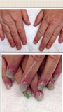 St. Patty Before and After Nails