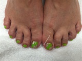 Lime And Pink Toes