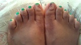 GREEN MEADOWS TOES