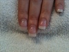 3 weeks after with Shellac