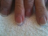 3 weeks after with Shellac 2
