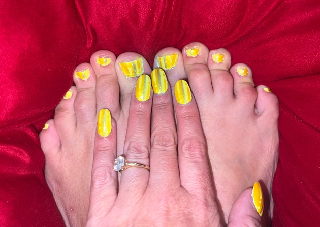 Summer Sun Yellow--Toes 