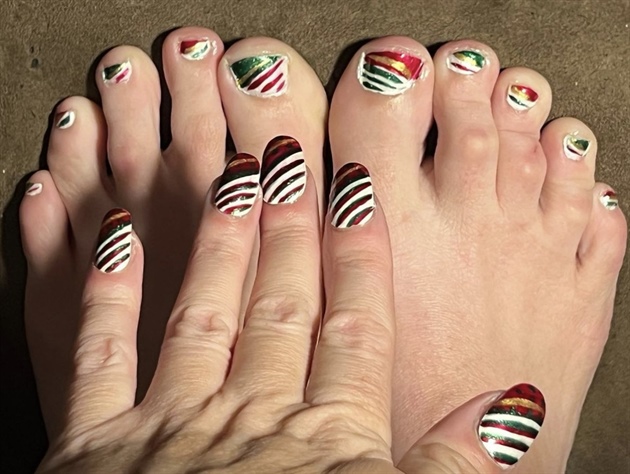 Candy Cane Vibes--Toes 