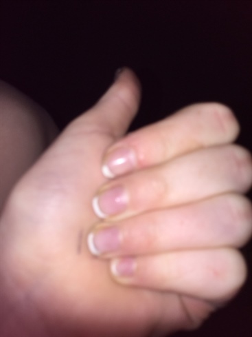 Messed Up Nails 