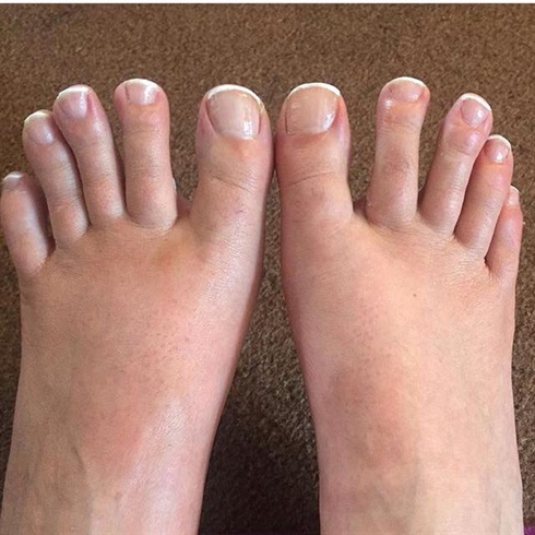 French manicure - Toes 