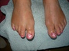 Holiday toes