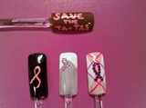 breast cancer 1