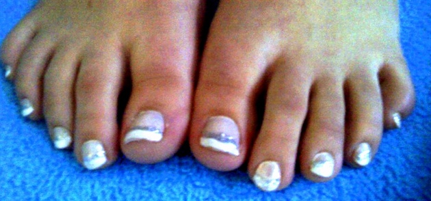 French Sparkle Toes by katebaby17