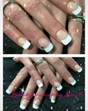 French Gel Nails With A High Smile Line