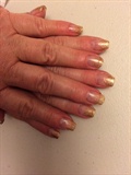 Gold Tips 