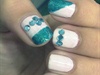 Glittery aqua blue and white nails