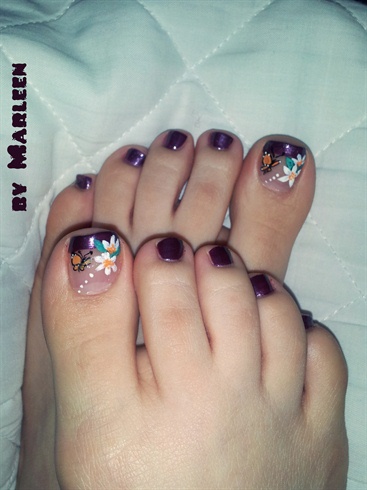 dark purple toes