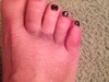 Black Shellac bruised toes