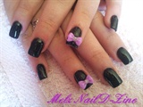 Black with 3D Bows