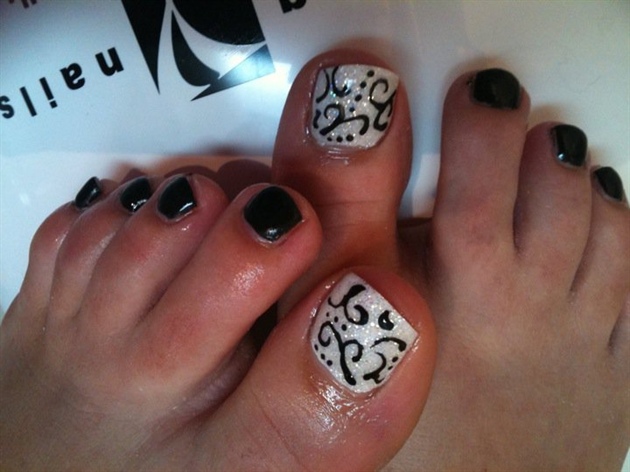 Gel Toes Black and White