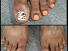 tiger toes 