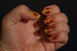 Zombie nails