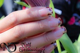 Nail Technology NT
