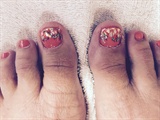 Bright Floral Toes