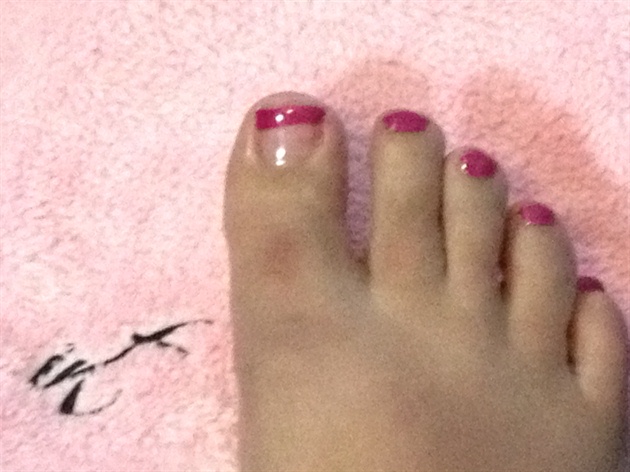 Pink Gel Toes