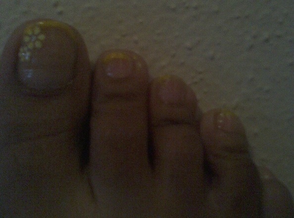 Yellow tipped toes