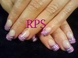 Orchid Glitter with Stripes