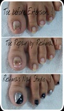 toe nail repair.. :)