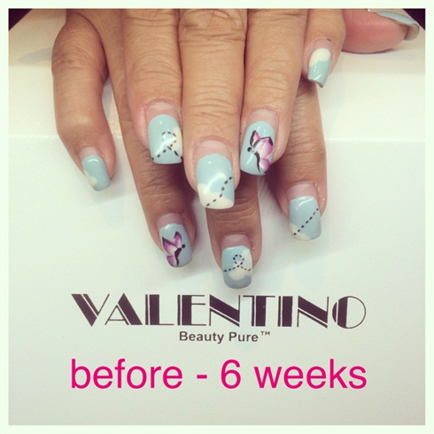 Before With 6 Weeks Of Growth by Sakura_Nails