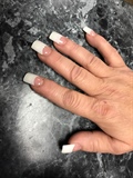 French tips