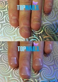 Rebuild your nail biters) 💅 🌺